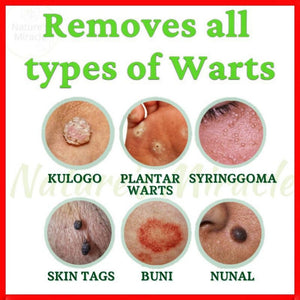 Natures Miracle Wart Remover