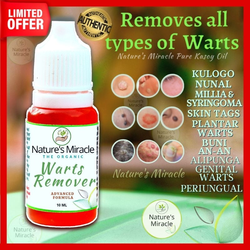 Natures Miracle Wart Remover