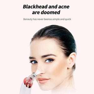 Electric Pore-Blackhead Vacuum Cleaner