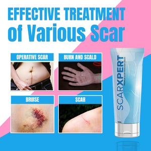 ScarXpert Premium Scar Remover Cream